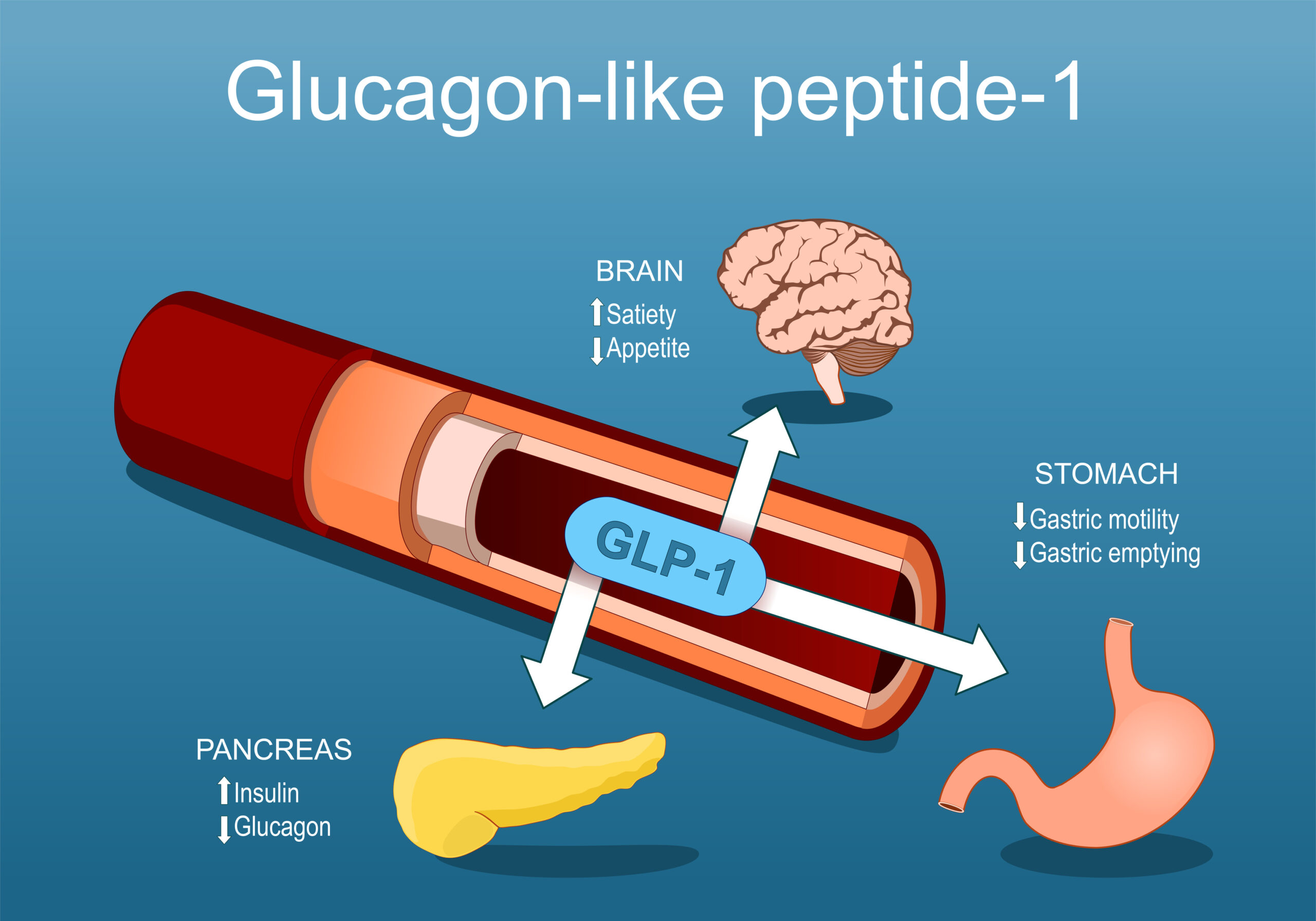 what are glp 1 patches for GLP-1 meds changed the game for me—but these @kind.patches are a great  support tool if you’re on that journey or just trying to curb cravings and  stabilize your appetite. They help stimulate your